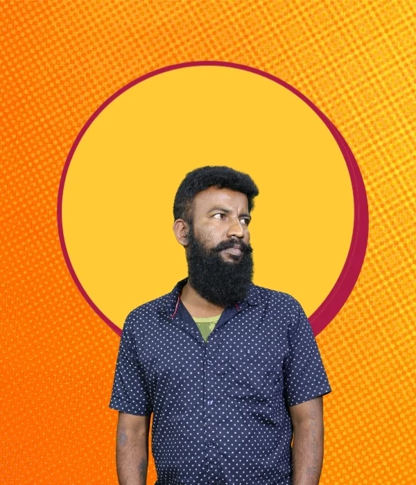 After hair patch — natural hairline restored, RK Hair Studio Marathahalli client 3