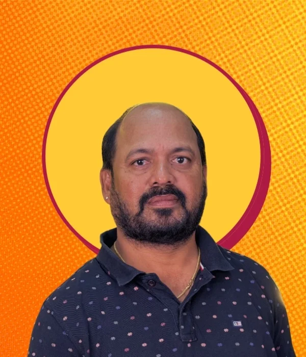Before hair patch — Marathahalli client 5, receding hairline