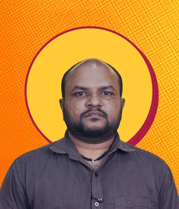 Before hair patch — Marathahalli client 6, thinning hair
